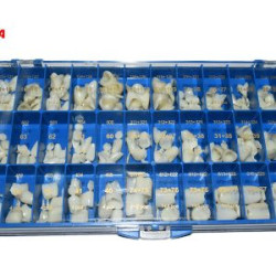 Anger Polycarbonate crowns Kit 144pcs