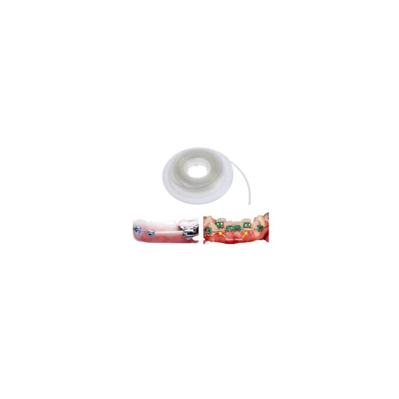 Archwire Sleeves