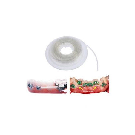 Archwire Sleeves