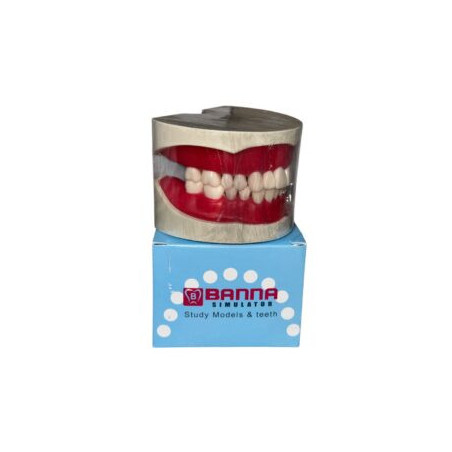 Cast Banna Magnatic With Extra Hard Teeth