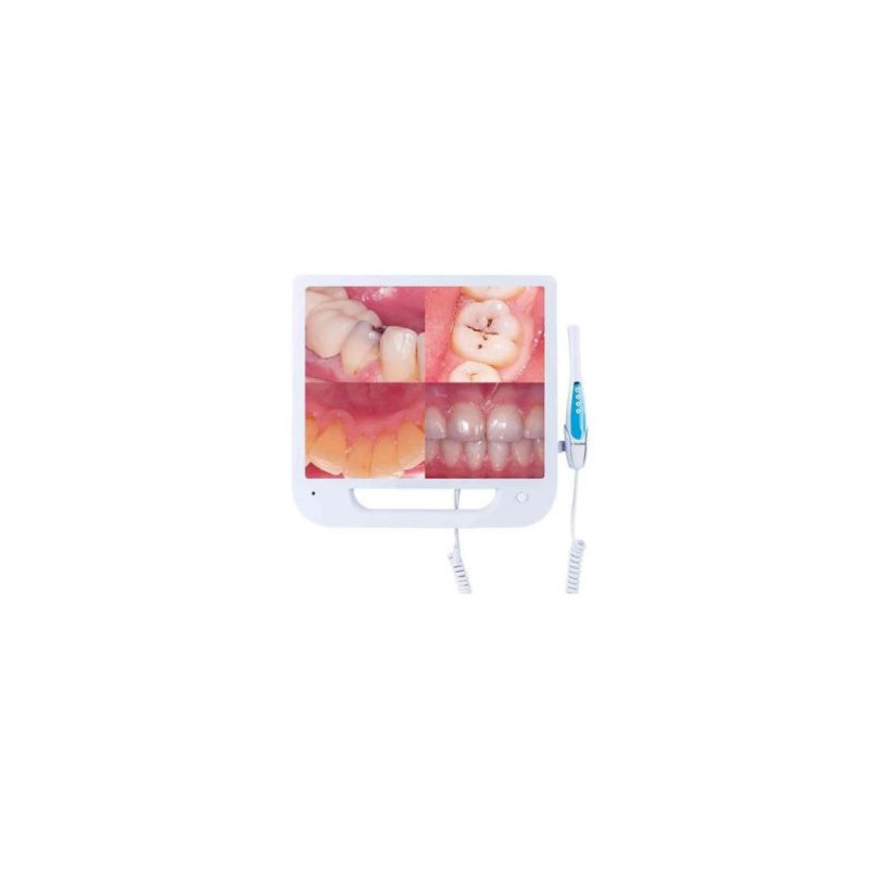starDent Intraoral Camera