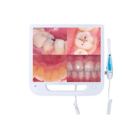 starDent Intraoral Camera