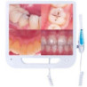 starDent Intraoral Camera