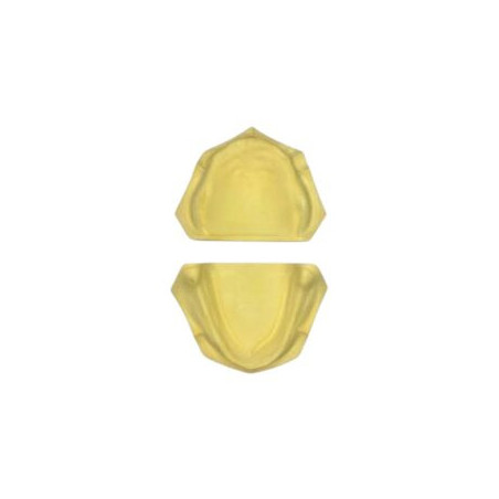 Edentulous Stone Cast