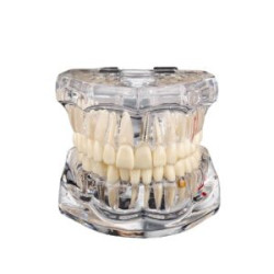 Transparent Cast
