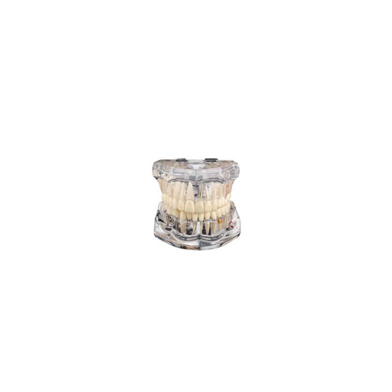Transparent Cast